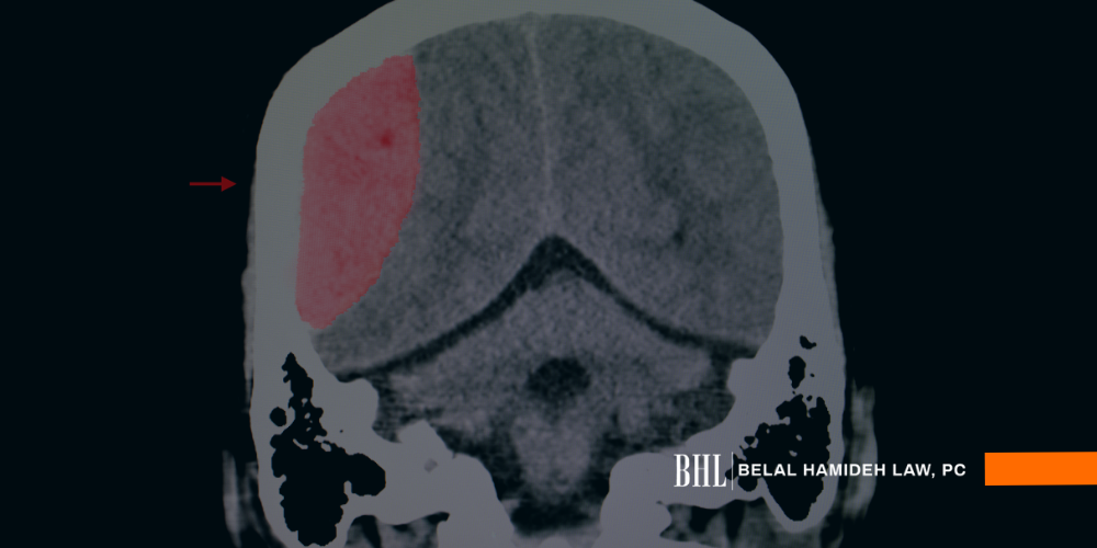 head injury attorney head injury attorney