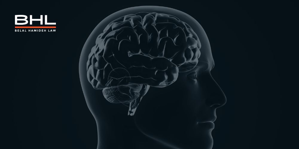traumatic brain injury lawyer long beach